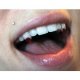 Small Blood-Tip Fangs